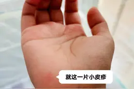 均是轻症，为何还要隔离？南方+记者探访基孔肯雅热治愈患者图片
