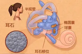 起身天旋地转，躺下如坠深渊，可能是这种病在作怪图片
