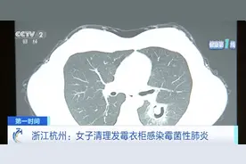 肺部“长满”霉菌！高烧不退！元凶竟是→图片