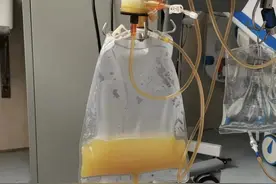 上海一男子外地回沪后突发剧烈腹痛，血脂超标……医生警告：严重或危及生命图片