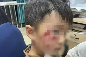 揪心！河南3岁男童被恶犬咬伤，18天后不幸离世，孩子母亲发声→图片