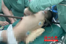 心疼！福建6岁男孩，身体被钢筋贯穿！医生这样救回来……图片