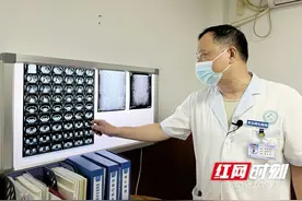 肾脏长结石对人体的危害究竟有多大？ 答案可能超出你的想象图片