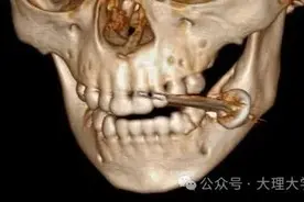 2岁宝宝咬下一口瞬间爆炸！这东西家家都有图片