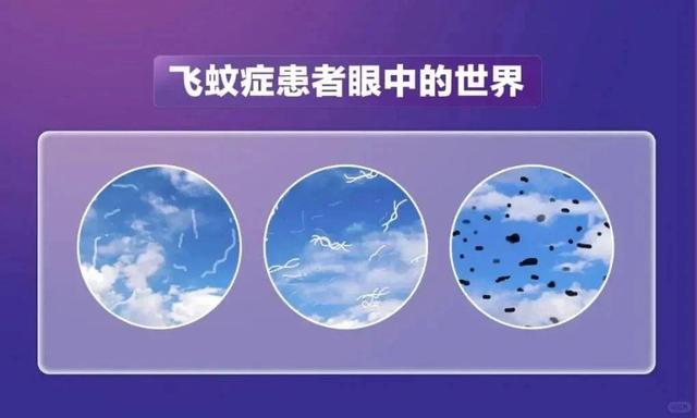 眼前飘“黑点”怎么办？有这些症状请就医