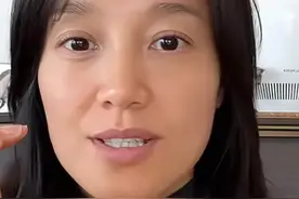 知名女主持自曝对鸡蛋过敏！“吃了40多年才知道”图片