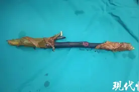 看着都疼！男子骑电动车摔倒，大腿被木棍穿透图片