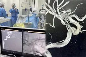 5岁女孩瞳孔异常反光似“猫眼”，竟是肿瘤信号！图片