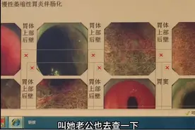 夫妻双双确诊癌症，“元凶”很多人餐桌上都有，致癌性很强！图片