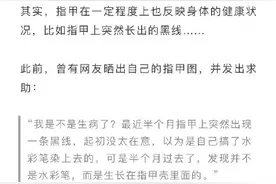 指甲突然出现黑线可能是癌变图片