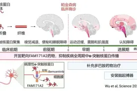 我国科学家发现帕金森病治疗新靶点图片