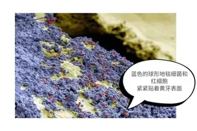 放大1000倍的牙齿太可怕了！看过你肯定会好好刷牙了图片