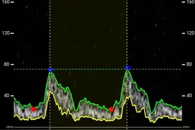 70岁汪建第二次登顶珠峰，华大完成首张世界之巅超声影像图图片