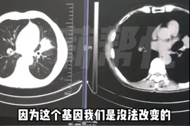 家族9人患癌8人离世！医生：几代人都有这个坏习惯图片