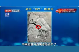 血管堵没堵，就看这2处！一个动作，激活脚上的“化血栓开关”图片