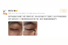 陶勇医生谈“郭艾伦眼睛受伤流血”：大概率会恢复得不错图片
