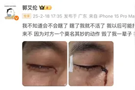 陶勇医生谈“郭艾伦眼睛受伤流血”：大概率会恢复得不错图片