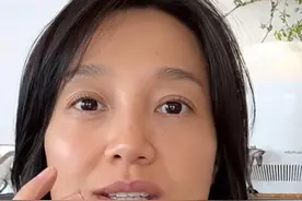 40多年才发现自己对鸡蛋过敏！医生：各种食物过敏皆有可能图片
