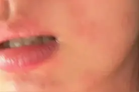 “痒到崩溃”！女演员晒照求助，网友大呼感同身受：太折磨人了，简直想把皮挠掉图片