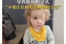 一个吻导致两岁宝宝左眼失明，这种病毒真的这么可怕吗图片