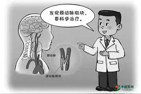 发现颈动脉斑块该怎么办图片