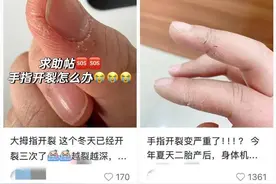 一到冬天手指为啥就开裂脱皮？专家建议抓住“黄金三分钟”图片