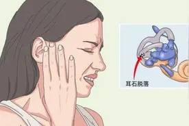 出现突发性眩晕，当心是耳石症惹的祸图片