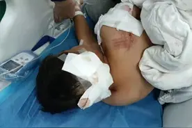 马上评｜男童被咬伤进ICU，给农村狗患敲响警钟图片