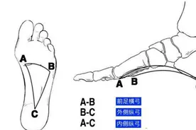 这种“踩屎感”鞋，月销过万，正在一步步毁掉你的脚......图片