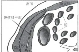 肚皮上打一针就不疼了？剖宫产术后止疼针，孕妈们了解一下！图片