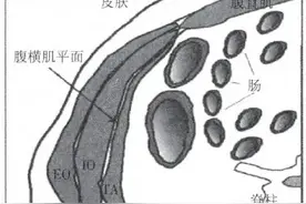 肚皮上打一针就不疼了？剖宫产术后止疼针，孕妈们了解一下！图片