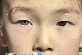 7岁女孩天生异瞳，一只黑色一只灰蓝色！妈妈：不影响视力健康图片
