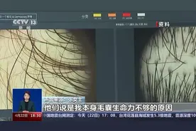 存活率成谜、维权难，植发成了“赌局”？央视曝光植发乱象图片