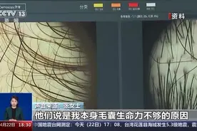 存活率成谜、维权难，植发成了“赌局”？央视曝光植发乱象图片