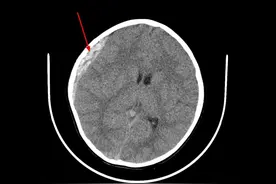 心碎！浙江2岁妹妹，3岁哥哥遇难……紧急提醒：不要去，不要去图片