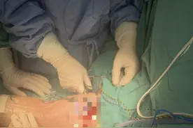 卒中后偏瘫肢体痉挛，这家医院用精细微创手术助力后续康复治疗图片