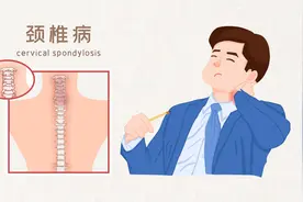 颈椎病有哪些类型？分别有何症状？一文了解图片