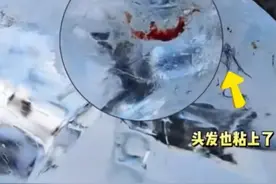 冬天千万别试！每年都有人中招→图片