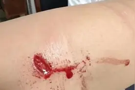 上海此地惊现两头暴躁鹿，3年内已有多人被撞伤！到底归谁管？图片