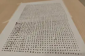 1791颗，密密麻麻！医生惊呆了：男子体内都是这些……这种病福建高发→图片