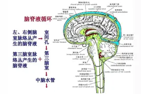 “大头娃娃”莫大意，要警惕先天性脑积水！图片