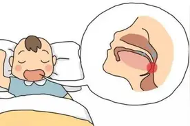 孩子打鼾睡得香？专家提醒可能呼吸道受阻！图片