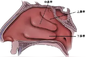 郑州民生耳鼻喉医院耳鼻喉医生告诉你：鼻甲肥大的危害与预防图片