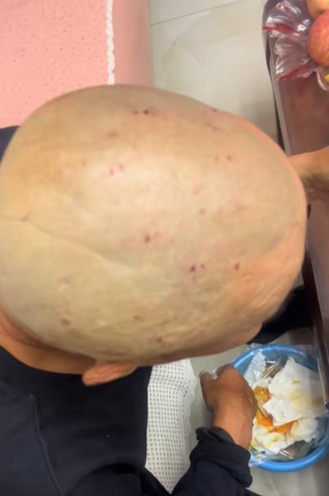 大爷花10元剃头后满头伤口不忍追责