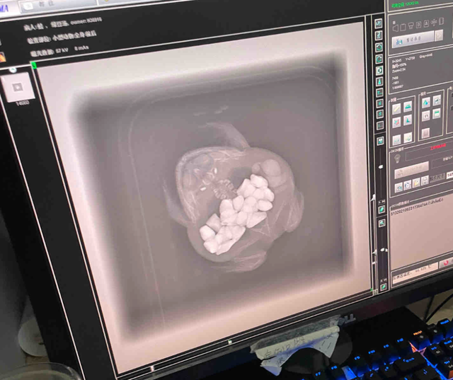 女子用胶水给受伤的蝴蝶粘上新翅膀，仅用5分钟，蝴蝶重返天空