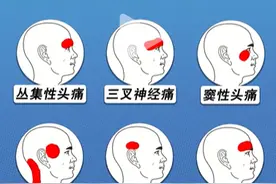 吃了止痛药头更疼了？有这些症状必须去医院！图片