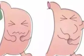 健康科普｜检查无异常，胃却总难受，这是为什么？图片