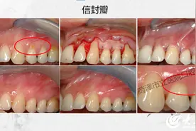 菏泽市立医院口腔科：职工医保待遇动态调整 起付线外可报销60%图片