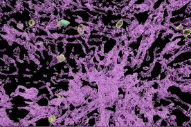 乙肝患者机体损伤原因揭示——肝脏血管细胞让免疫系统“休眠”图片