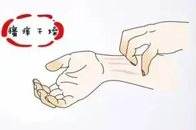 痒痒痒~这些冬季皮肤问题，怎么预防？图片
